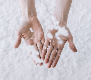 snowflakes